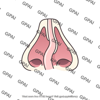 Deviated nasal septum