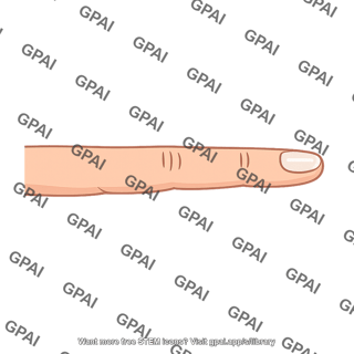 Finger