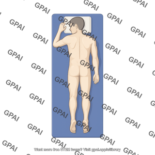 Surgical position prone swimmers dorsal adult male on bed