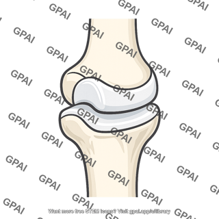 Hinge joint