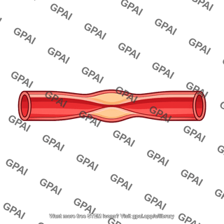 Blood vessel stenosed