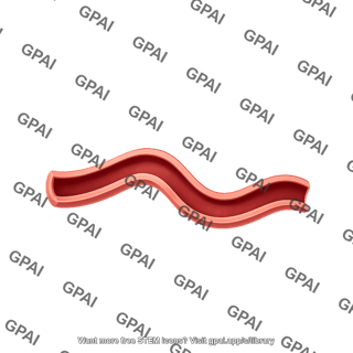 Vessel squiggle 2