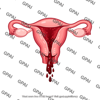 Bleeding uterus