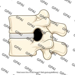 Intervertebral foramen