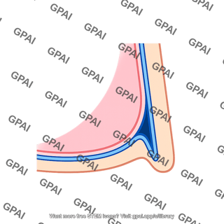 Pleural recess