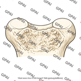 Posterior intercondylar area