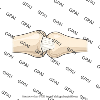 Medial collateral ligament metacarpophalangeal joint