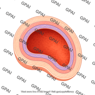 Vessel cross section muscular artery external elastic membrane
