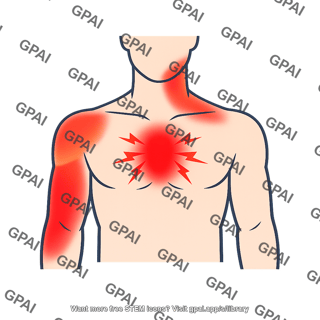 Heart attack symptom pattern