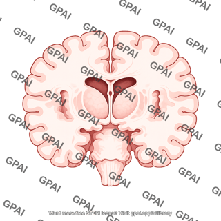 Brain coronal cut thalamus caudal