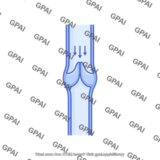 Venous valve closed