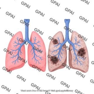 Lungs human healthy vs diseased generic