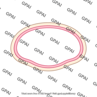 Peritoneal cavity