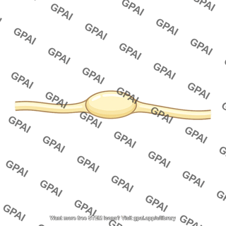 Superior glossopharyngeal ganglion