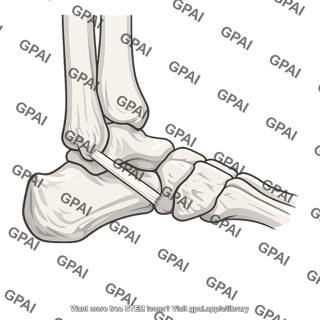 Calcaneofibular ligament