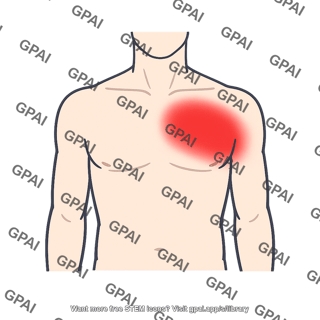 Chest shoulder pain map