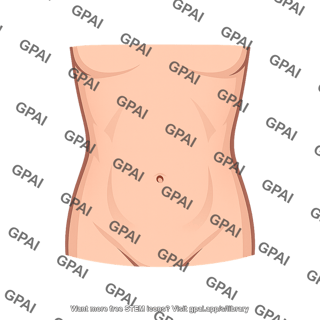 Anterior abdominal wall surface