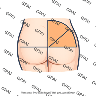 Gluteal quadrant