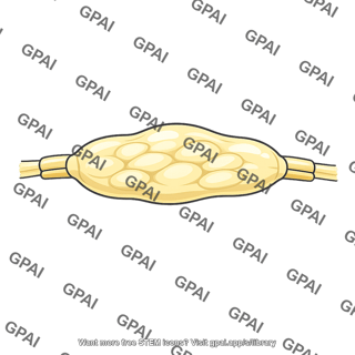 Nerve edema