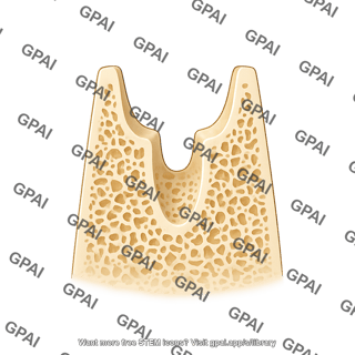 Tooth premolar bone woven
