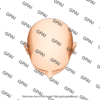 Male balding stage 0 superior 913