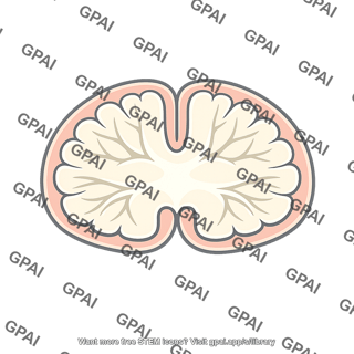 White matter branching mass