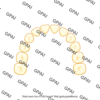 Dentition primary upper teeth only
