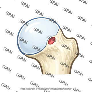 Femur head