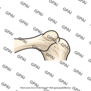 Bone joint