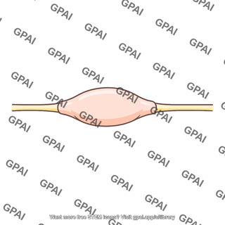 Posterior root ganglion