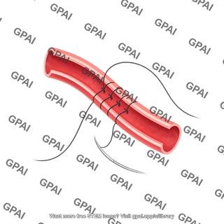 Vessel being sutured