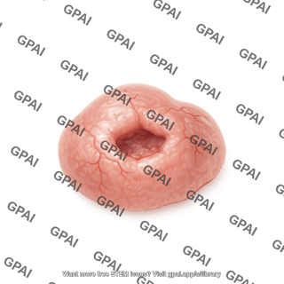 Basal cell carcinoma skin cancer