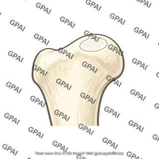 Facet on greater trochanter