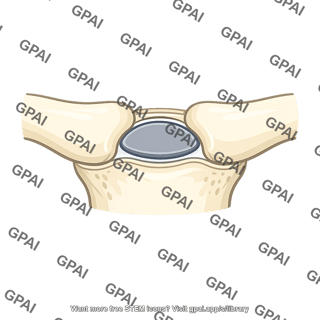 Sternoclavicular joint