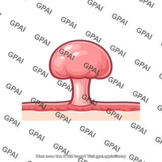 Benign polyp