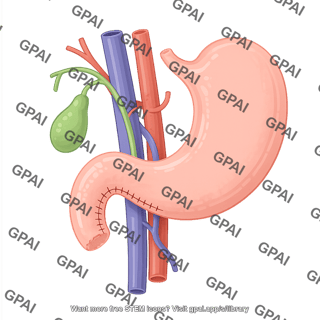 Pancreatectomy total 426