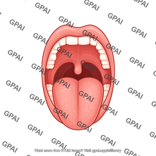 Mouth open mallampati score class 3