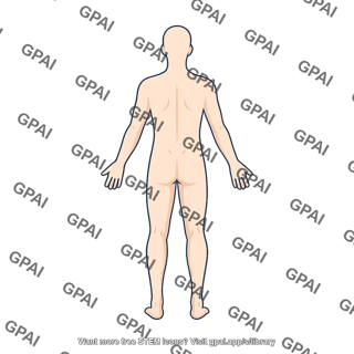 Adult male posterior hairless