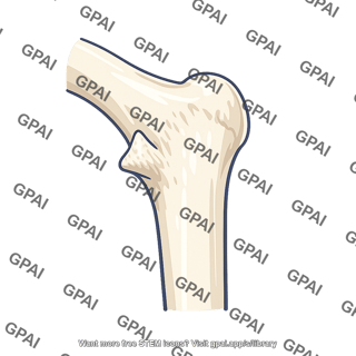 Lesser trochanter of femur