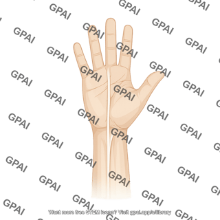 Hand and wrist palmar view with palmaris longus tendon