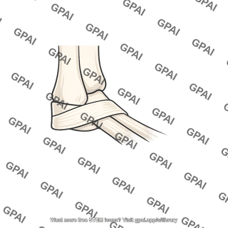 Fibular retinaculum