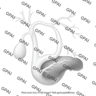 Double duct sign coronal mrcp t2 weighted 104