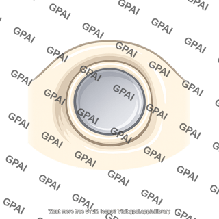 Round window
