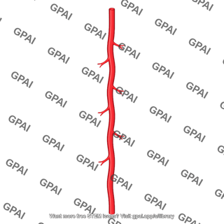 Anterior spinal artery