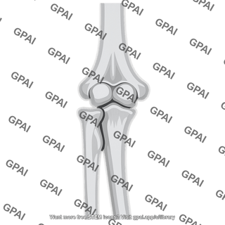 Radiograph anteroposterior elbow