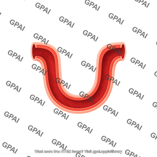 Vessel u shape
