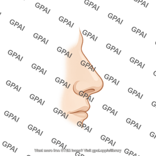 Nose lateral