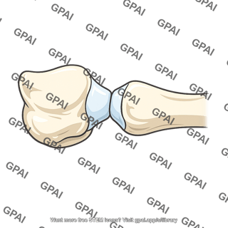 Carpometacarpal joint