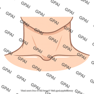 Suprasternal notch