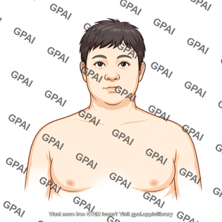 Adult 3 male stage i obesity head 32